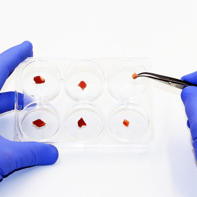 A scientist holds a multi-well plate with pieces of raw cultured meat in the biotechnology laboratory. Synthetic or in vitro meat production concept. Cultured meat.